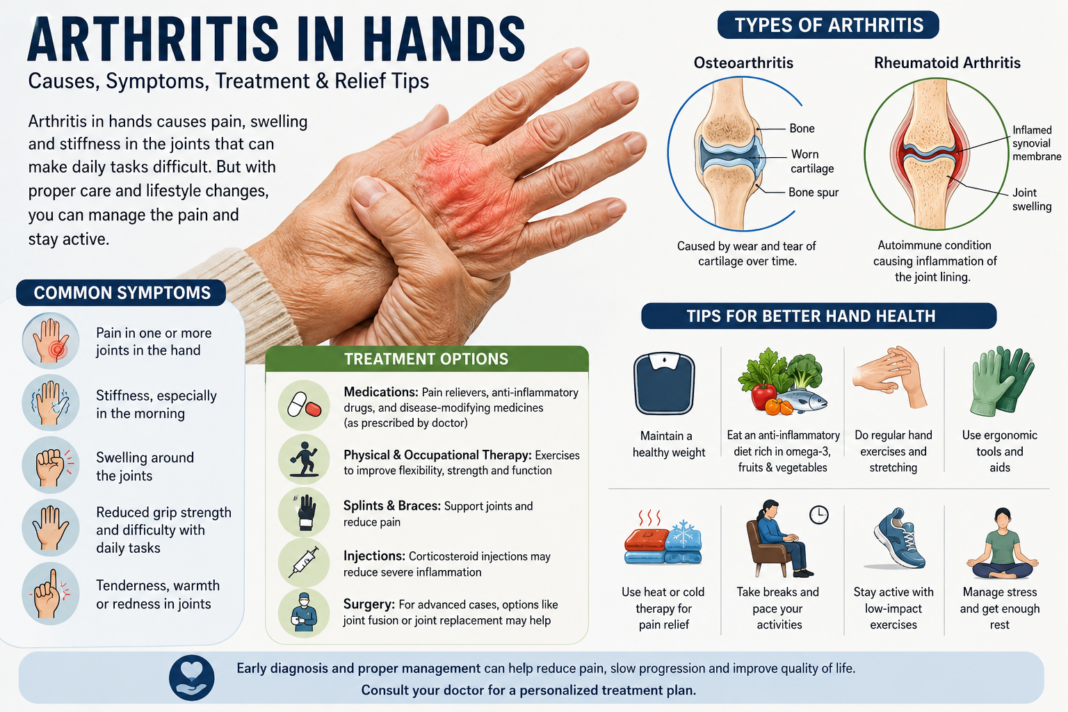 Arthritis in Hands